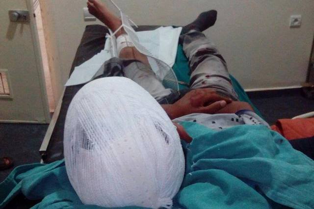 بسبب ركنة سيارة  . . عامل يحطم رأس شاب بآلة حادة !!